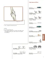 Preview for 33 page of Stryker Triathlon Surgical Manualline