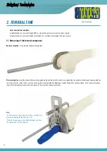 Preview for 12 page of Surgival Genutech CCK Surgical Technique