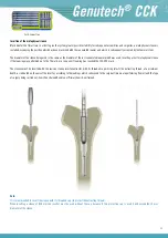 Preview for 15 page of Surgival Genutech CCK Surgical Technique