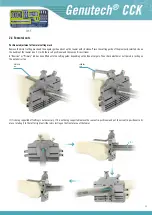 Preview for 17 page of Surgival Genutech CCK Surgical Technique