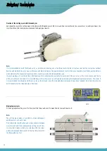 Preview for 20 page of Surgival Genutech CCK Surgical Technique