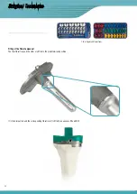 Preview for 30 page of Surgival Genutech CCK Surgical Technique