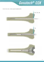 Preview for 37 page of Surgival Genutech CCK Surgical Technique