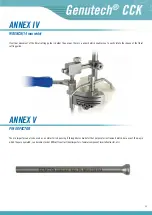 Preview for 41 page of Surgival Genutech CCK Surgical Technique