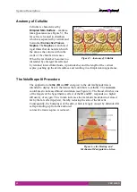 Preview for 20 page of Syneron Candela VelaShape III System User Manual