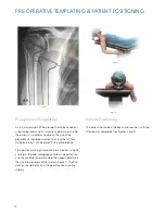 Preview for 10 page of Synthes Delta Xtend Manual