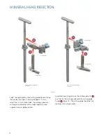 Preview for 14 page of Synthes Delta Xtend Manual