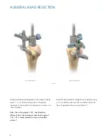 Preview for 16 page of Synthes Delta Xtend Manual