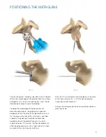 Preview for 21 page of Synthes Delta Xtend Manual