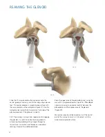 Preview for 22 page of Synthes Delta Xtend Manual