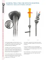 Preview for 34 page of Synthes Delta Xtend Manual