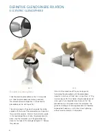 Preview for 42 page of Synthes Delta Xtend Manual