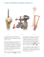 Preview for 48 page of Synthes Delta Xtend Manual