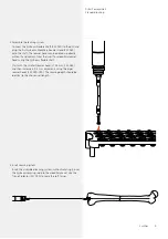 Preview for 12 page of Synthes DFN Surgical Technique