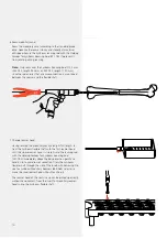 Preview for 13 page of Synthes DFN Surgical Technique