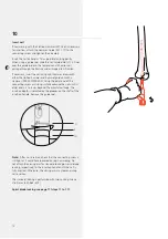 Preview for 15 page of Synthes DFN Surgical Technique