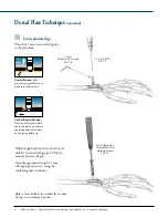 Предварительный просмотр 12 страницы Synthes Dorsal Manual