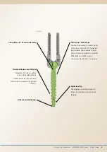 Preview for 7 page of Synthes EXPEDIUM VERSE System Manual