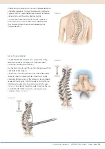 Preview for 21 page of Synthes EXPEDIUM VERSE System Manual