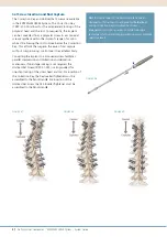 Preview for 24 page of Synthes EXPEDIUM VERSE System Manual
