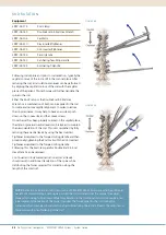 Preview for 26 page of Synthes EXPEDIUM VERSE System Manual