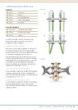 Preview for 33 page of Synthes EXPEDIUM VERSE System Manual