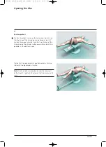 Preview for 11 page of Synthes Expert Tibial Nail Technique Manual