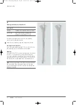 Preview for 20 page of Synthes Expert Tibial Nail Technique Manual