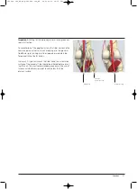 Preview for 47 page of Synthes Expert Tibial Nail Technique Manual