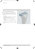 Preview for 48 page of Synthes Expert Tibial Nail Technique Manual