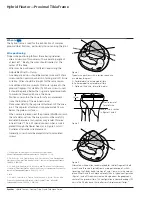 Preview for 6 page of Synthes Hybrid Fixator Proximal Tibia Frame Technique Manual