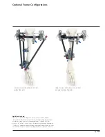 Preview for 9 page of Synthes Hybrid Fixator Proximal Tibia Frame Technique Manual