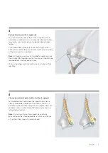 Preview for 9 page of Synthes LCP Distal Humerus Plates Technique Manual