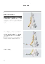 Preview for 16 page of Synthes LCP Distal Humerus Plates Technique Manual