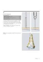 Preview for 19 page of Synthes LCP Distal Humerus Plates Technique Manual