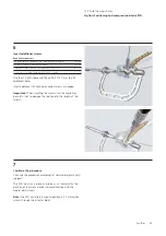 Preview for 25 page of Synthes LCP Distal Humerus Plates Technique Manual