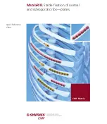 Synthes MatrixRIB Quick Reference preview