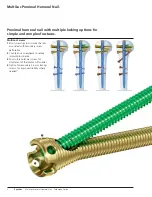 Preview for 4 page of Synthes MultiLoc Proximal Humeral Nail Technique Manual