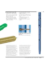 Preview for 5 page of Synthes MultiLoc Proximal Humeral Nail Technique Manual