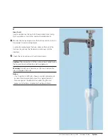 Preview for 19 page of Synthes MultiLoc Proximal Humeral Nail Technique Manual