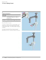 Preview for 28 page of Synthes MultiLoc Proximal Humeral Nail Technique Manual