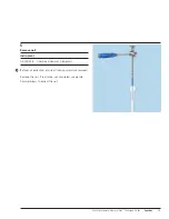 Preview for 41 page of Synthes MultiLoc Proximal Humeral Nail Technique Manual