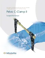 Preview for 1 page of Synthes Pelvic C-Clamp II Manual