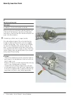 Preview for 9 page of Synthes Pelvic C-Clamp II Manual