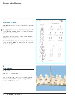 Preview for 6 page of Synthes Small Stature USS Technique Manual