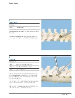 Preview for 7 page of Synthes Small Stature USS Technique Manual