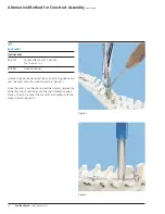 Preview for 16 page of Synthes Small Stature USS Technique Manual