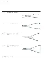 Preview for 28 page of Synthes Small Stature USS Technique Manual