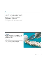 Предварительный просмотр 11 страницы Synthes Spine Cable System Technical Manual