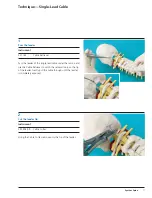 Предварительный просмотр 13 страницы Synthes Spine Cable System Technical Manual